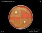 optochin resistant alfa-streptococci